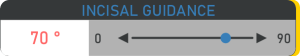 Cut out - 03 - Incisal guidance - 06